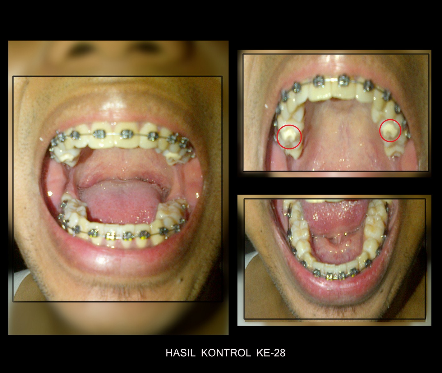Imaya Dental Clinic ONOMENULIS   